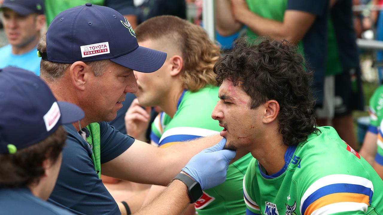 Xavier Savage will miss the first six rounds of the season with a jaw injury. Picture; NRL Photos