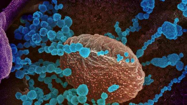 Electron microscope image of SARS-CoV-2 (round blue objects), the virus that causes COVID-19, emerging from the surface of cells cultured in the lab. Photo supplied National Institutes of Health.