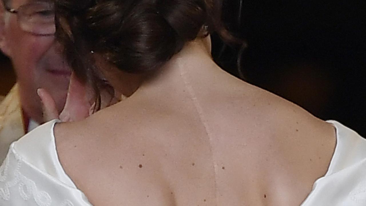 Princess Eugenie proudly showed her scar during the ceremony. Picture: Getty