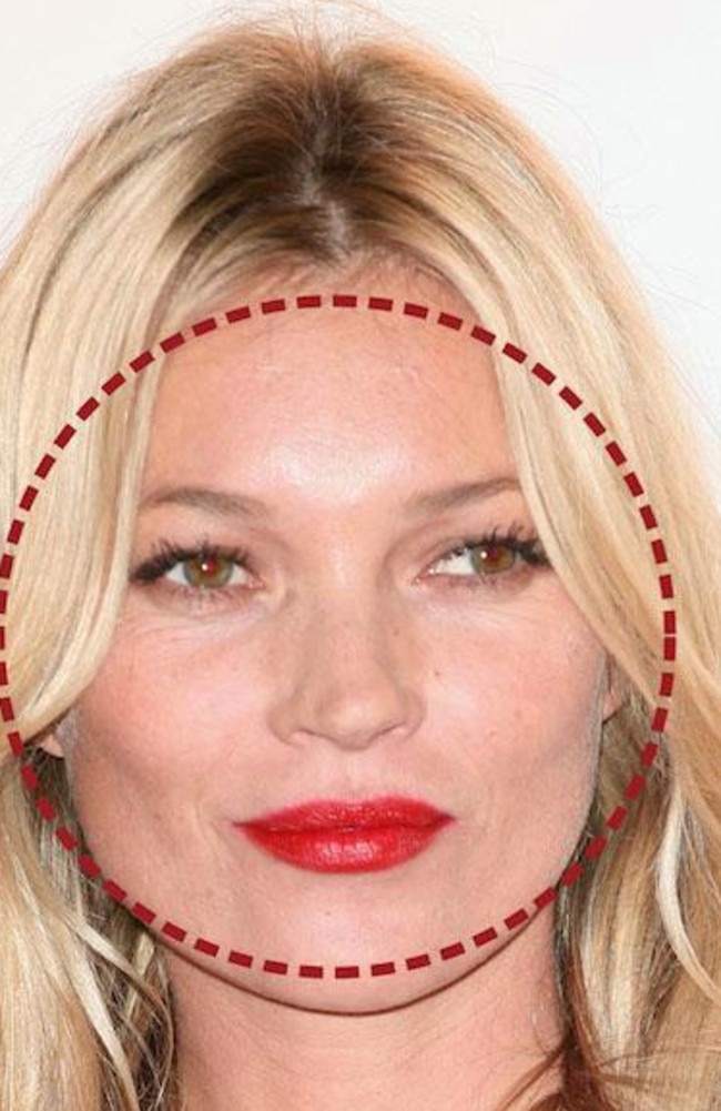 Kate Moss also has a round face, but Dr de Silva says it is less desirable in an adult.