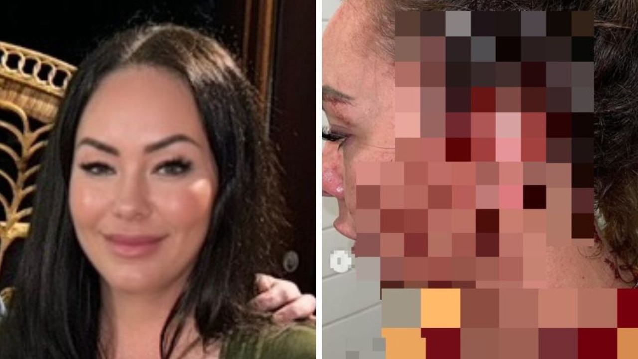 ‘Ridiculous’: Mum’s fury at reaction to attack