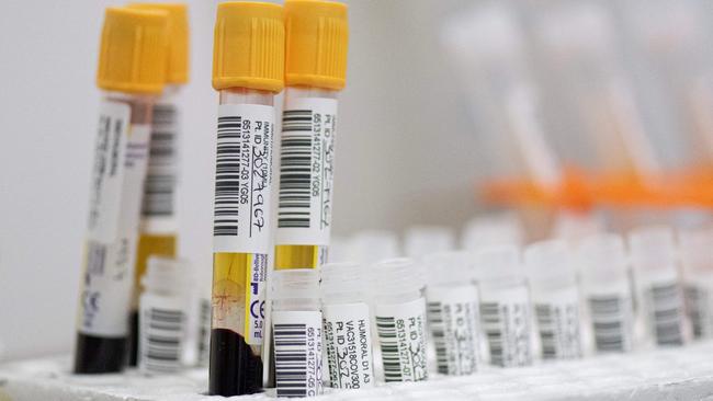 Blood samples at the Center for Pediatrics Infectology Studies where the pharmaceutical company Janssen is developing the phase 3 study of the vaccine in Cali, Colombia. Picture: AFP