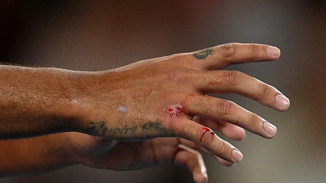 Kyrgios’ hand after he’d cleaned it off. Picture: AAP