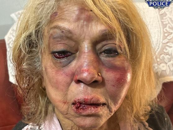 Ninette  Simons received severe facial bruising and swelling after she was  assaulted during a shocking home invasion at her Girrawheen home earlier this month.  Credit: WA Police/Supplied