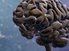 Major development for Alzheimer’s disease that will help Aussies now