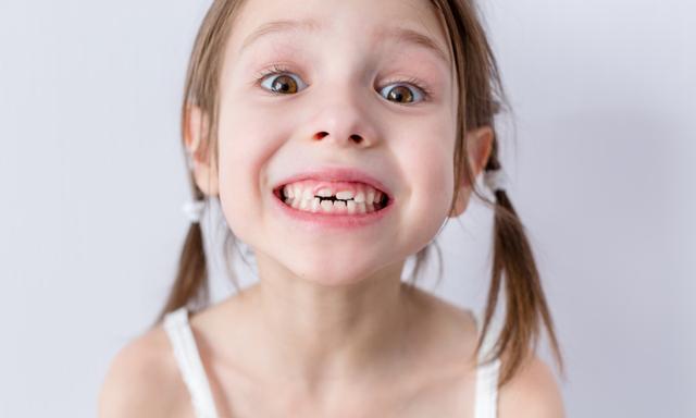This is what causes crooked teeth in kids