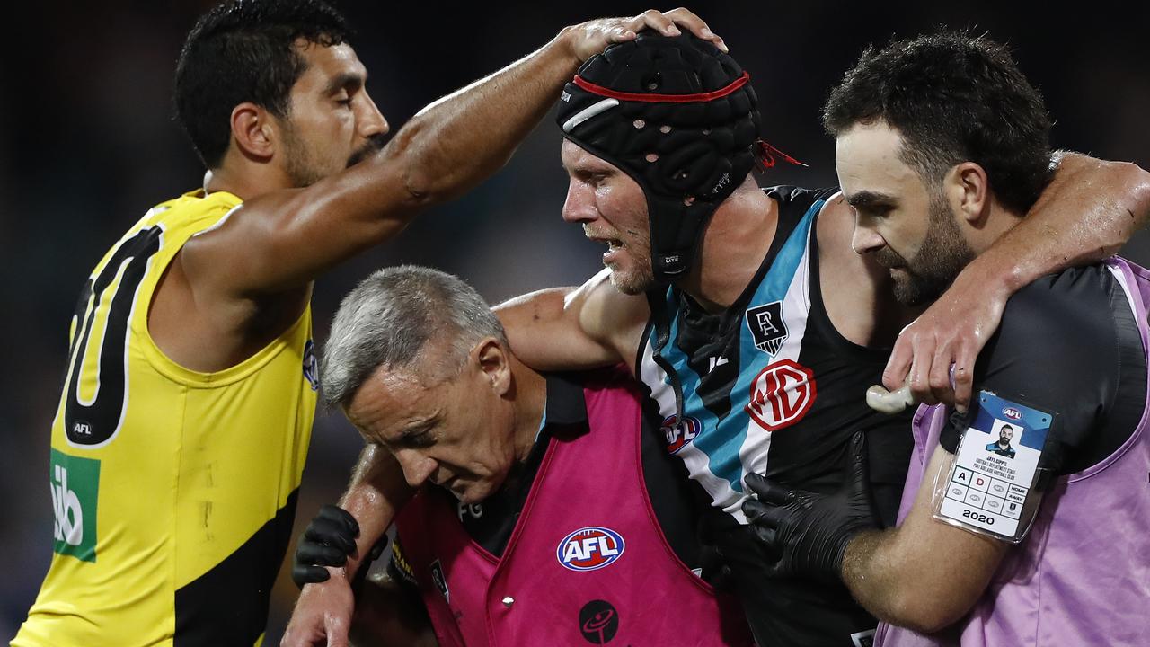The AFL has updated its concussion guidelines (Photo by Ryan Pierse/Getty Images).