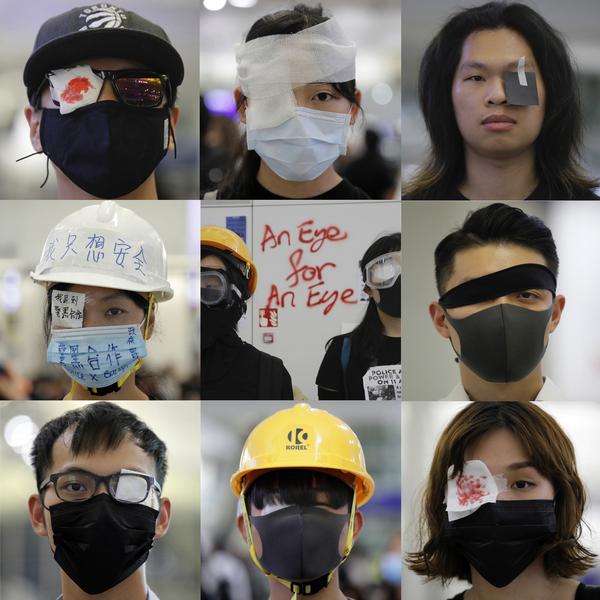 Over the past week, protesters have worn eyepatches in solidarity with a woman who lost her eye to a rubber bullet.