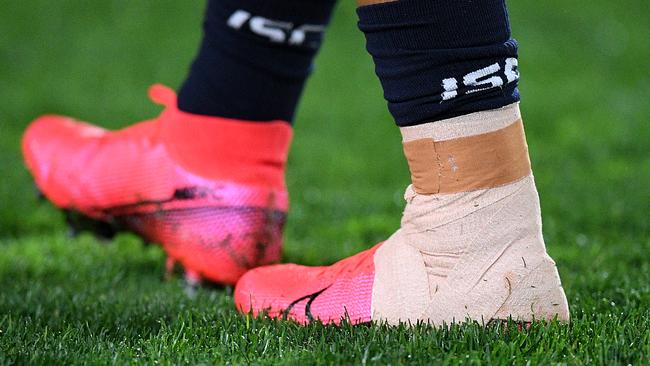 Strapping is seen around the ankle of Cowboys player Valentine Holmes. Picture: AAP