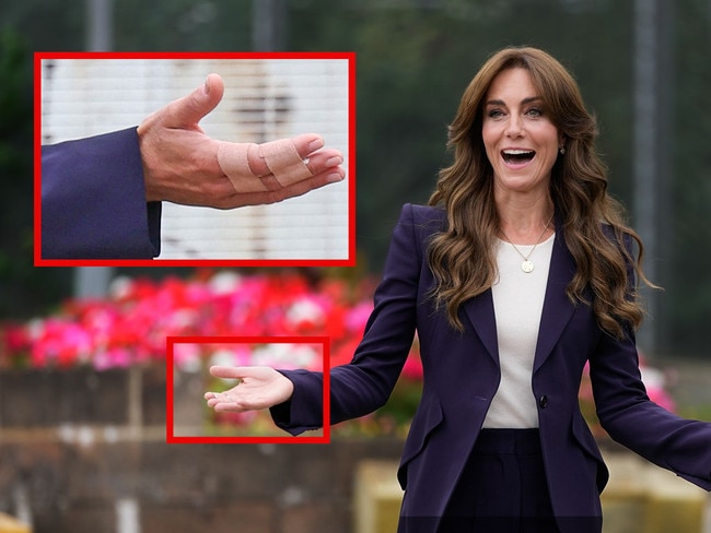 Princess Catherine visiting a prison with hand injury.