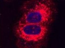 A diagram of how infrared light and a molecular jackhammer can affect a cancer cell. Picture: Ciceron Ayala-Orozco/Rice University