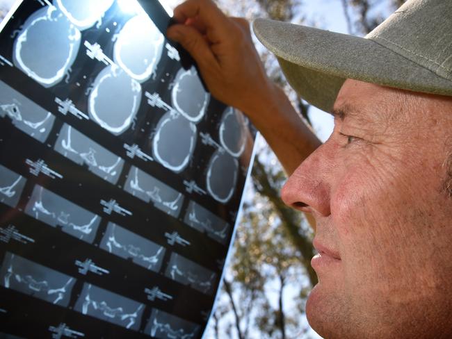 Scans of Shane Newton’s damaged ear. Picture: Dr Roland von Marburg