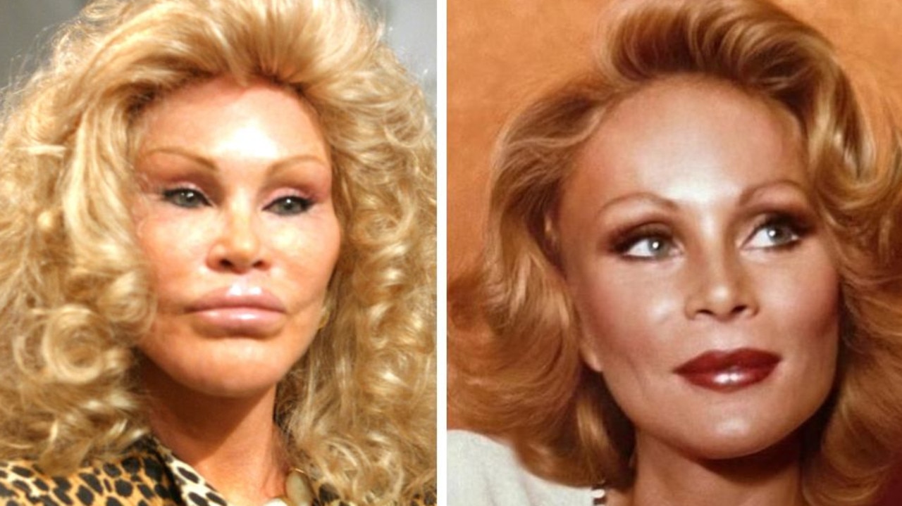 Catwoman Jocelyn Wildenstein dead at 84