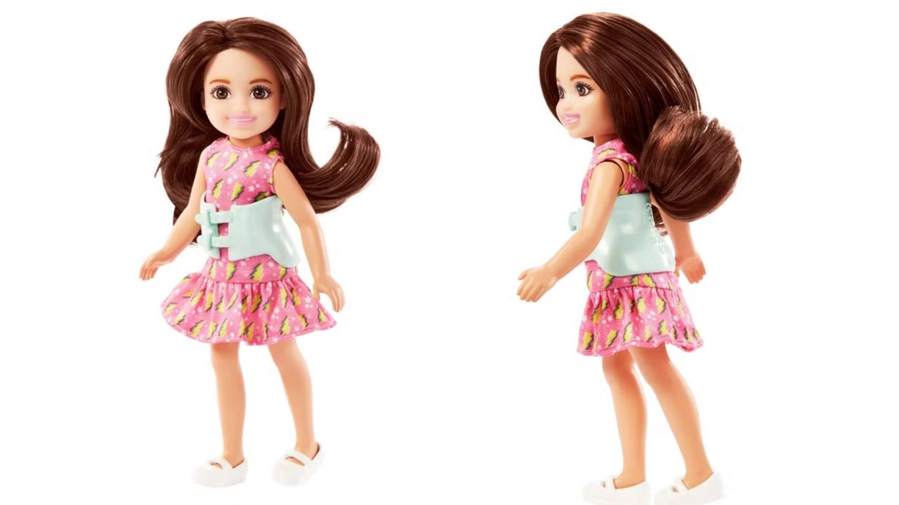 Mattel, the makers of Barbie, has introduced its first-ever doll with scoliosis. The toy company has launched its new Chelsea doll, who is Barbie’s little sister, with a curved spine and a removable back brace. Picture: Supplied