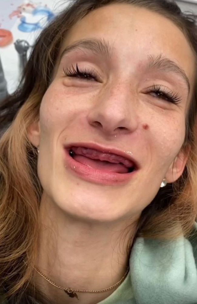 Brittany prior to her dental transformation. Picture: TikTok/brittanynegler