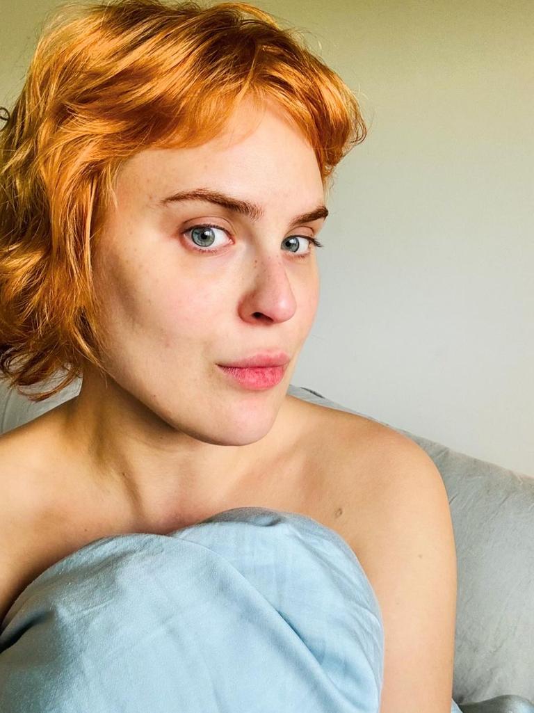 Tallulah Willis reveals ‘real’ face after having filler dissolved | The ...