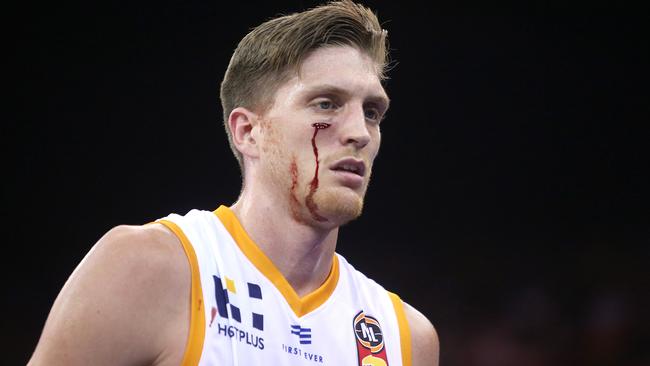 Matt Hodgson was left bloodied by a blow during the Bullets loss. Picture: Getty Images