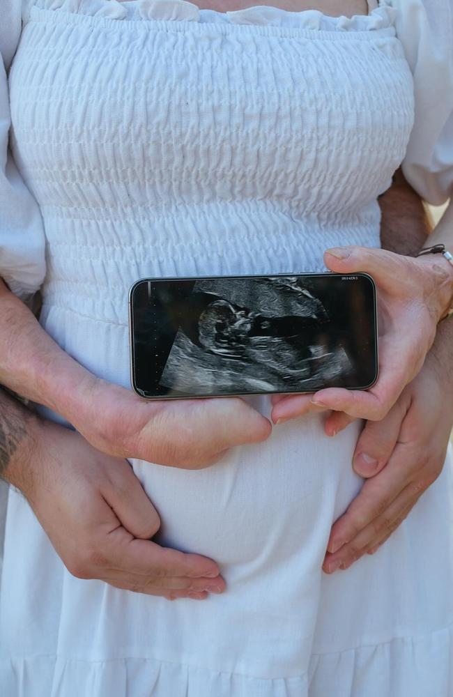 They are expecting their first child. Picture: Instagram/Sophie Delezio