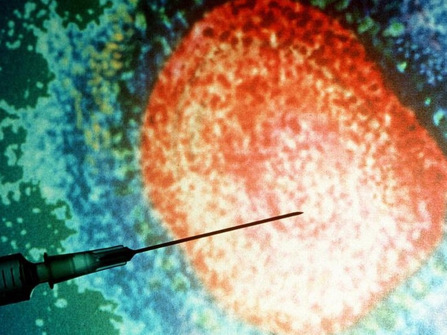 Measles generic.  Picture: Getty