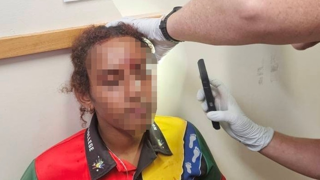 A student at Northern Peninsula Area State College receives medical attention after being injured in a brawl on school grounds. Picture: Supplied