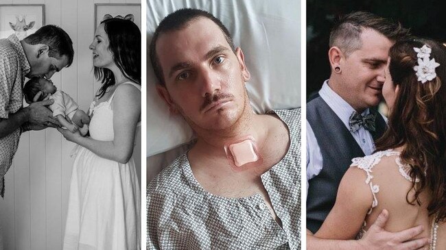Mackay man wakes from coma to meet a wife he can’t remember