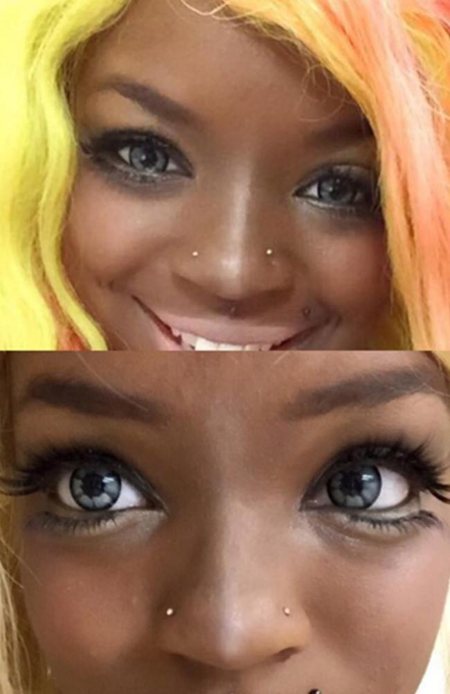 Beauty addict reveals what her eyes look like before and after getting injected with fillers.