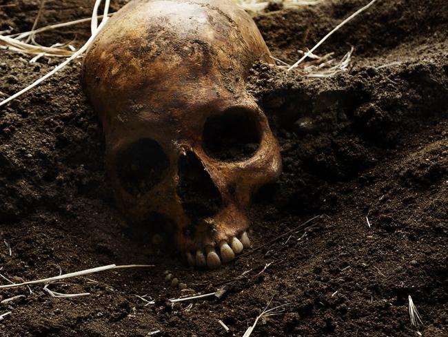 In this photo taken on July 19, 2014, the skull of Perfecto de Dios killed in 1950 at the age of 19 is partially visible during his exhumation from a hidden grave in Chaherrero, Spain. Across Spain, volunteer teams of archeologists, anthropologists and forensic scientists head out every year on expeditions to dig for suspected mass graves _ a legacy of Spain’s fascist past during the time of General Francisco Franco. (AP Photo/Daniel Ochoa de Olza)