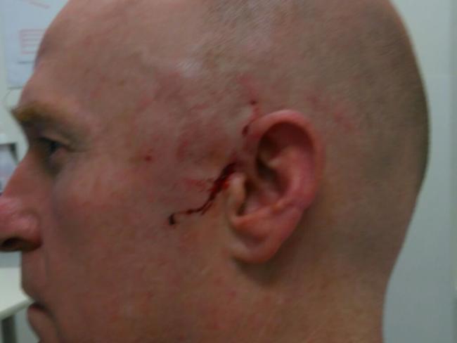 Leading Senior-Constable Dale Annesley was hit in the face with a brick.