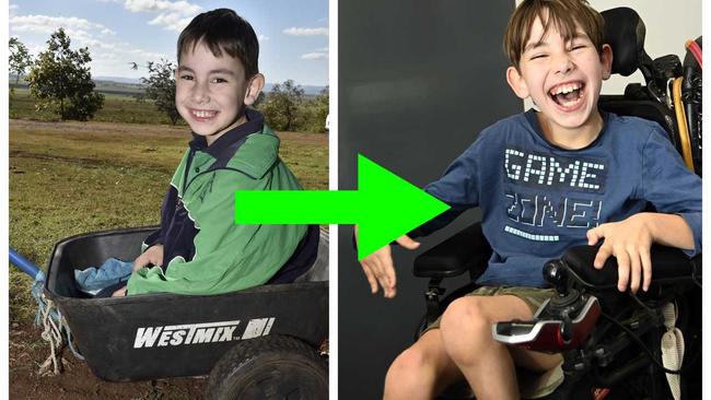 Angus Hopkins, one year on after getting his wheelchair.