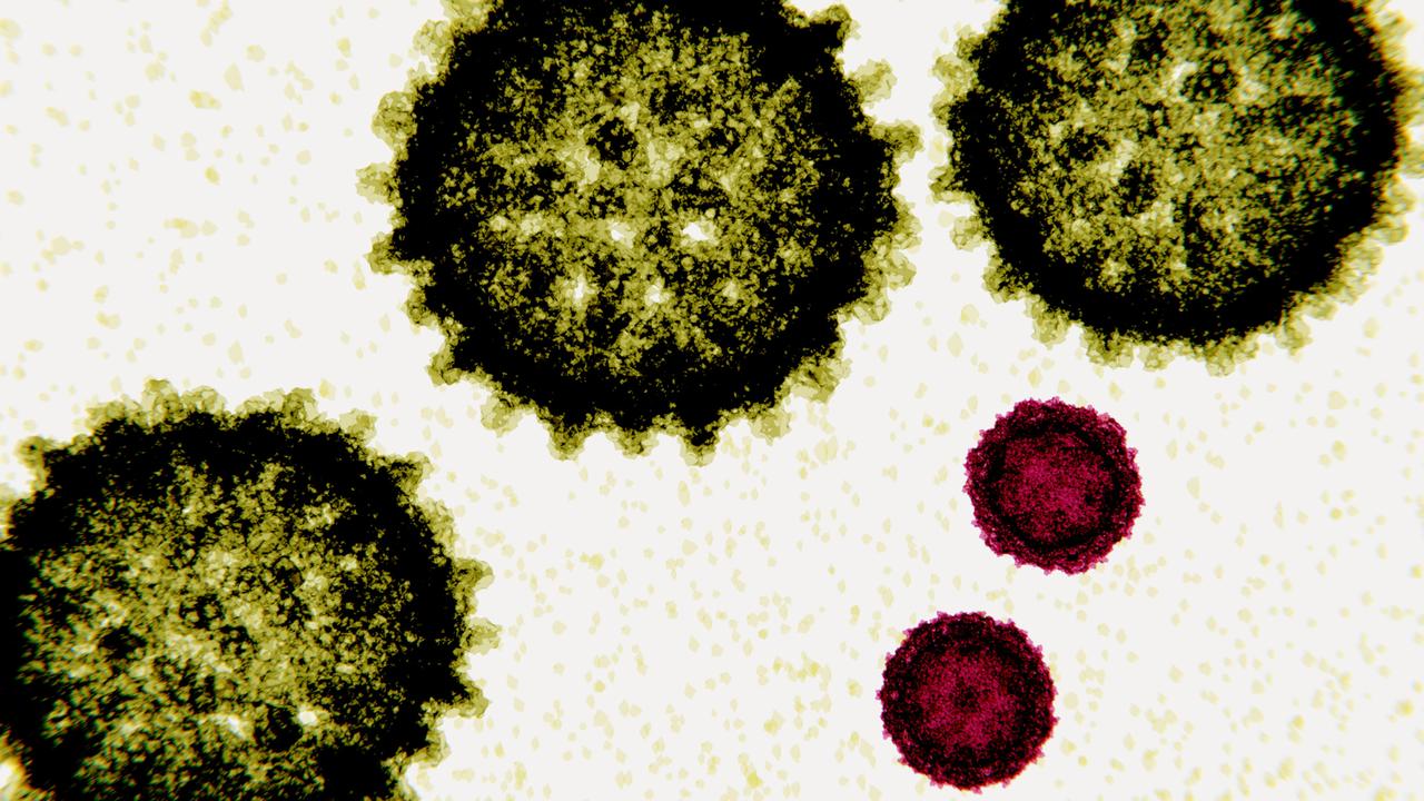 Poliovirus is a simple RNA virus 30 nm in diameter. Poliovirus causes poliomyelitis.