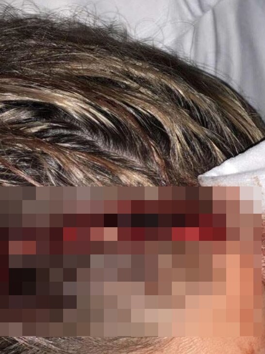 The female guard sustained a 12cm wound to her head so deep she had to have emergency surgery in hospital.