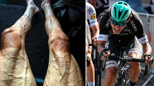 Tour de France Rider Poljanski shows off the punishment endured by his legs and, right, in action during the race.