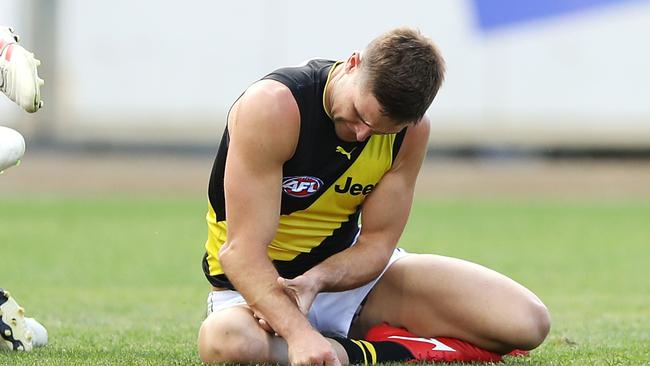 Jayden Short’s dislocated elbow was on show for all to see. Pic: Getty Images