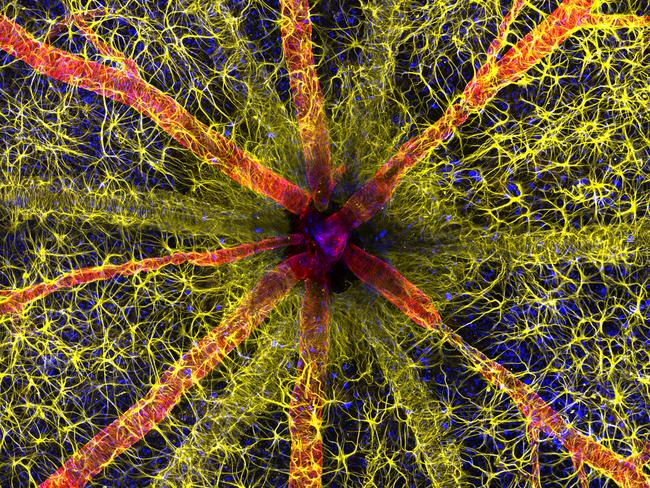 Rodent Optic Nerve Head Wins the 49th Annual Nikon Small World Photo Microscopy Competition. Photo: Hassanain Qambari