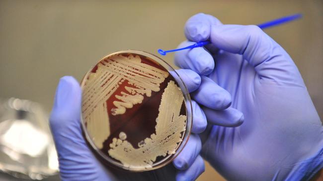 A Melioidosis bacteria sample.