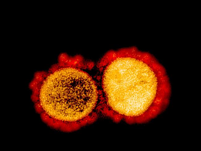 SARS-CoV-2 virus particles, isolated from a patient. Picture: AFP