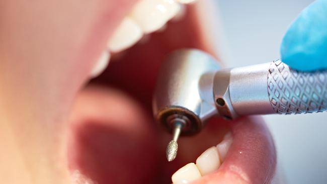 New research by business marketing website Localsearch says the Gympie region had the highest demand for dentists in Queensland, and the second highest in the country. Photo: iStock