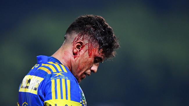 Parramatta Eels Kaysa Pritchard copped a head wound during Saturday's game against the North Queensland Cowboys at TIO stadium in Darwin, NT. Picture: Justin Kennedy