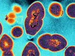 31/05/2005 PIRATE: Vancomycin resistant enterococci (VRE) bacteria, a life-threatening superbug as viewed under a microscope in 2005 image Pic. Supplied