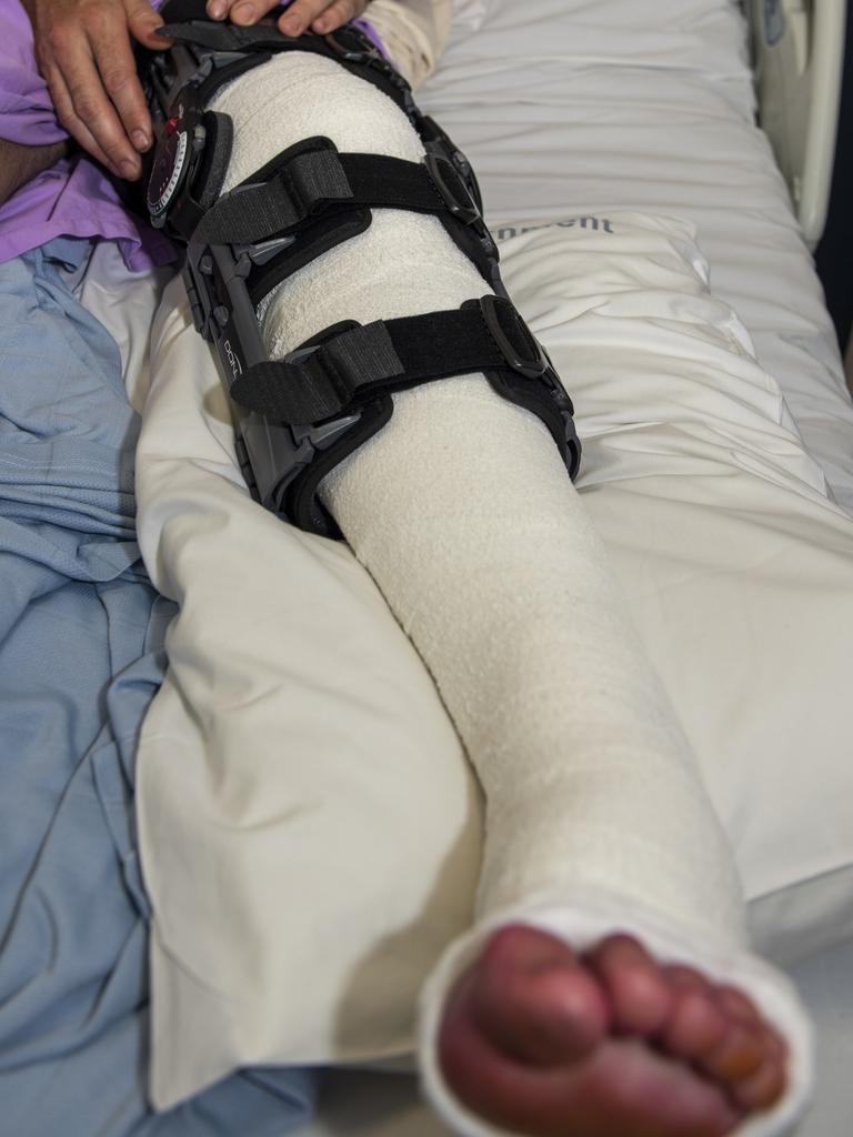 Whitsunday shark attack victim Todd Price at Mackay Base Hospital after surgery on his leg. Picture: Michaela Harlow