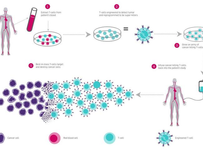 Scientists have discovered how to engineer the body’s own T-cells to better recognise and destroy tumour cells, with promising early results. Diagram: The Parker Institute