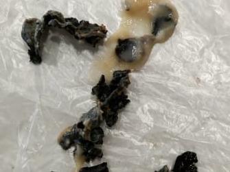 A shocked mother has warned against buying a popular brand of Woolworths baby food after opening the packet and finding it full of “black, rubbery stuff”. Picture: Supplied