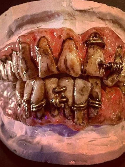 Barbed wire dentures created by Jac Charlton from Stingray Studios.