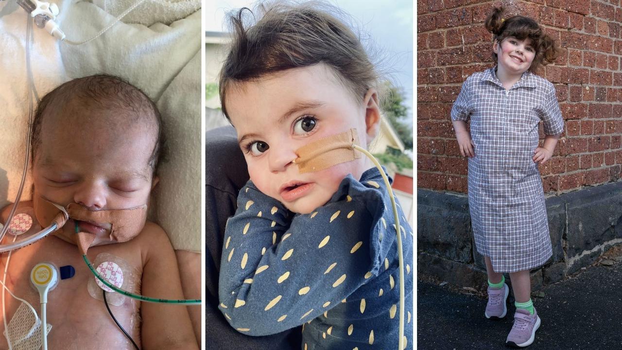 Her life hung in the balance at birth, but look at Esme now