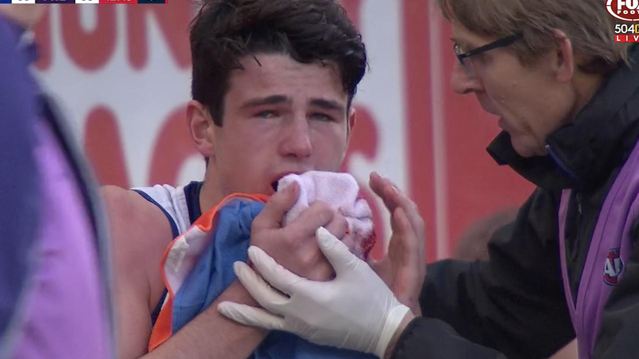 A distraught Andrew Brayshaw after the Gaff punch.