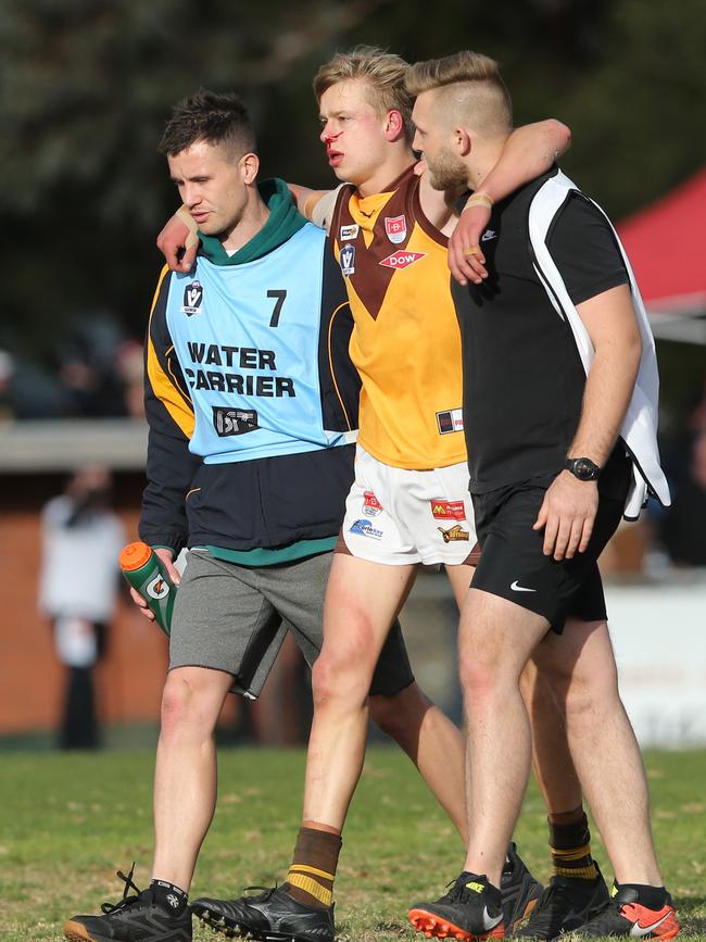 Drysdale's Luke Preece is helped from the ground late in the game. Picture: Alan Barber