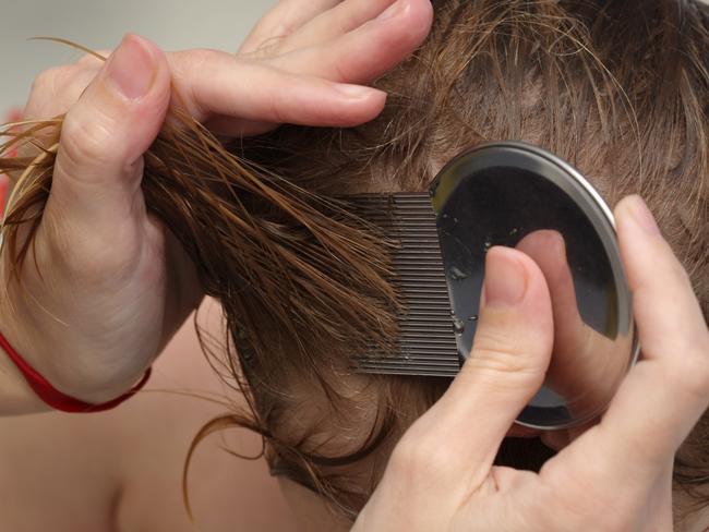 Head lice, a type of ectoparasite, feeds by sucking blood from the scalp of its host. Picture: iStock