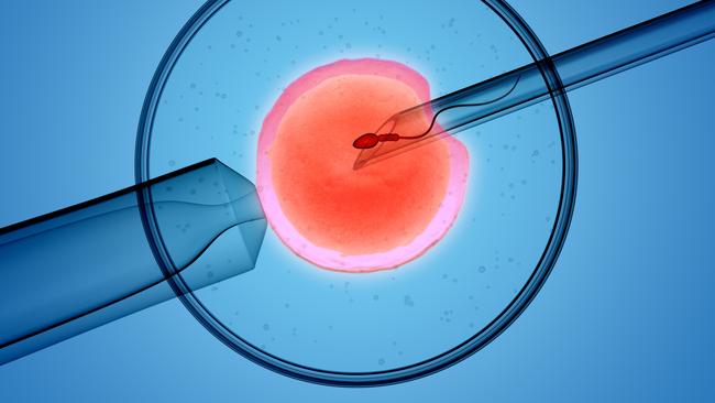 Secret documents released by the TGA have raised questions about the conduct of Monash IVF. Picture: Istock