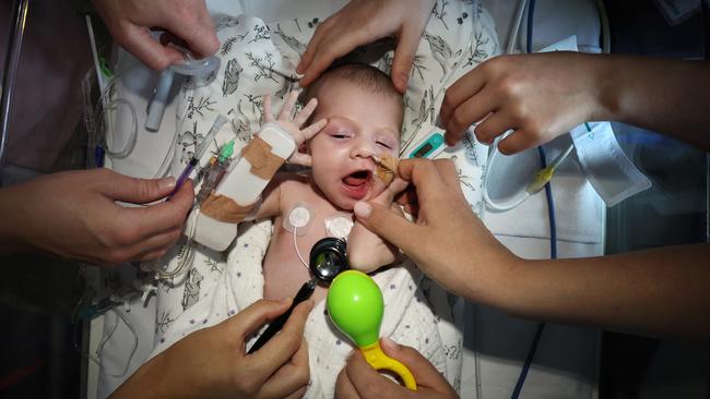 Zoe Loizou is one of the babies who is lovingly being cared for in the NICU. Picture: David Caird