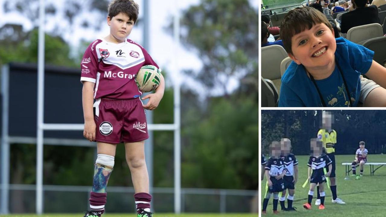 ‘Isolated’: How boy, 6, with prosthetic leg was sidelined
